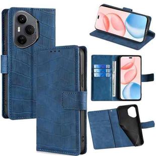 For Honor 400 Pro Global 160.8mm Skin Feel Crocodile Magnetic Clasp Leather Phone Case(Blue)