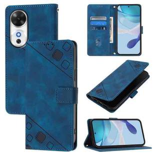 For Honor Play 60 5G Skin-feel Embossed Leather Phone Case(Blue)