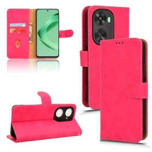 For Huawei nova 11 SE Skin Feel Magnetic Flip Leather Phone Case(Rose Red)