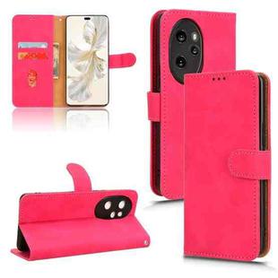 For Honor 100 Pro 5G Skin Feel Magnetic Flip Leather Phone Case(Rose Red)