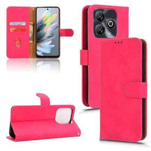 For ZTE Blade A75 Skin Feel Magnetic Flip Leather Phone Case(Rose Red)