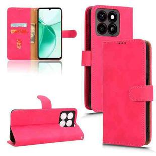 For ZTE Blade A35 / A55 Skin Feel Magnetic Flip Leather Phone Case(Rose Red)