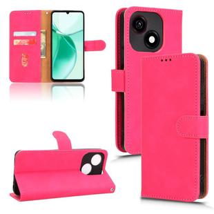 For ZTE Blade A35e 4G Skin Feel Magnetic Flip Leather Phone Case(Rose Red)
