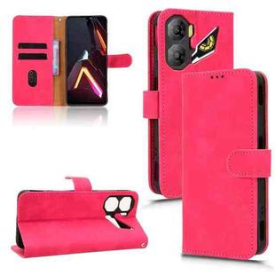 For ZTE nubia Neo 3 Skin Feel Magnetic Flip Leather Phone Case(Rose Red)