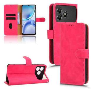 For ZTE Blade A36 4G Skin Feel Magnetic Flip Leather Phone Case(Rose Red)