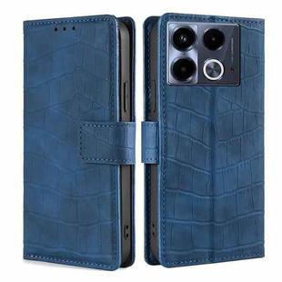 For Infinix Note 40 4G Skin Feel Crocodile Magnetic Clasp Leather Phone Case(Blue)