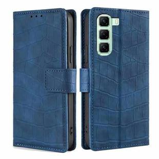 For Infinix Hot 50 4G Skin Feel Crocodile Magnetic Clasp Leather Phone Case(Blue)