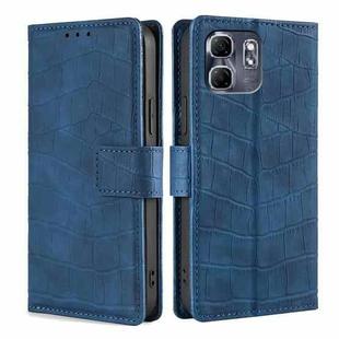 For Infinix Hot 50i 4G Skin Feel Crocodile Magnetic Clasp Leather Phone Case(Blue)