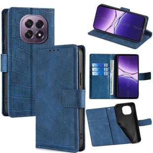 For OPPO A5 5G 2025 Global Skin Feel Crocodile Magnetic Clasp Leather Phone Case(Blue)