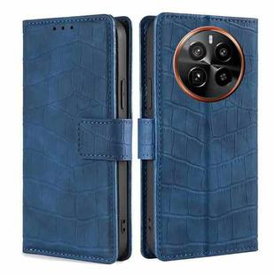 For Realme GT5 Pro 5G Skin Feel Crocodile Magnetic Clasp Leather Phone Case(Blue)