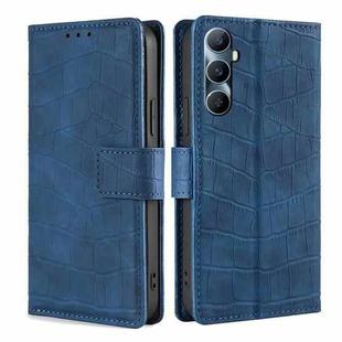 For Realme C65 4G Skin Feel Crocodile Magnetic Clasp Leather Phone Case(Blue)