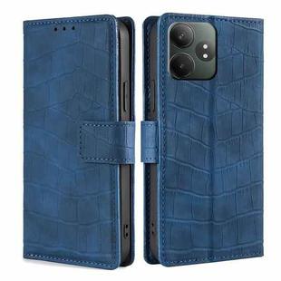 For Realme GT Neo6 SE Skin Feel Crocodile Magnetic Clasp Leather Phone Case(Blue)