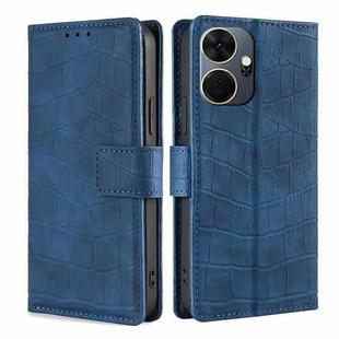 For Itel P55+ 4G Skin Feel Crocodile Magnetic Clasp Leather Phone Case(Blue)