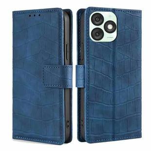 For Itel A50 4G Skin Feel Crocodile Magnetic Clasp Leather Phone Case(Blue)