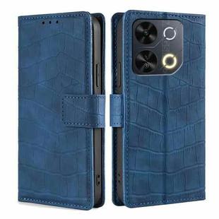 For Itel P65 Skin Feel Crocodile Magnetic Clasp Leather Phone Case(Blue)