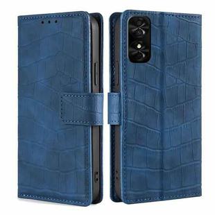 For TCL 50 SE 4G Skin Feel Crocodile Magnetic Clasp Leather Phone Case(Blue)