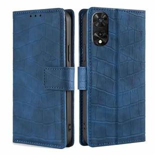 For TCL 505 4G Skin Feel Crocodile Magnetic Clasp Leather Phone Case(Blue)