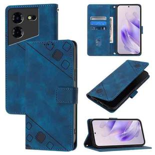 For Tecno Pova 5 4G Skin Feel Embossed Leather Phone Case(Blue)