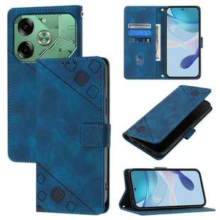 For Tecno Pova 6 Skin Feel Embossed Leather Phone Case(Blue)