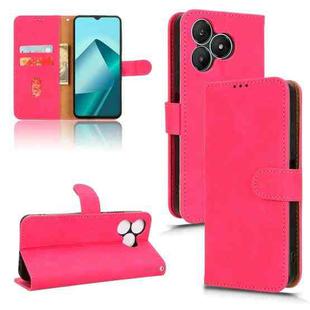 For Wiko T20 Skin Feel Magnetic Flip Leather Phone Case(Rose Red)