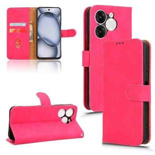 For itel A80 Skin Feel Magnetic Flip Leather Phone Case(Rose Red)