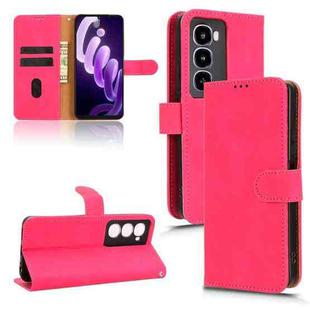 For itel City 100 Skin Feel Magnetic Flip Leather Phone Case(Rose Red)