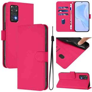 For Redmi Note 11 4G Global Skin Feel Solid Color Leather Phone Case with Lanyard(Rose Red)