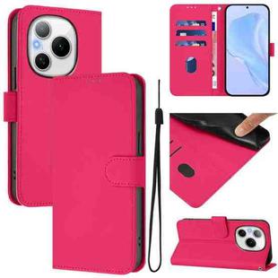 For Honor Power 5G Skin Feel Solid Color Leather Phone Case with Lanyard(Rose Red)