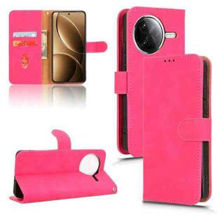 For Xiaomi Poco F7 Pro / F7 Ultra Skin Feel Magnetic Flip Leather Phone Case(Rose Red)