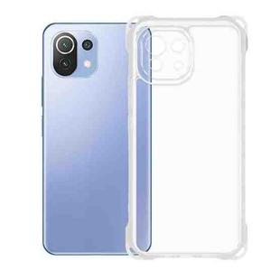 For Xiaomi 11 Lite Kalebol 1.5mm Thickened Four-Corner Shockproof TPU Phone Case
